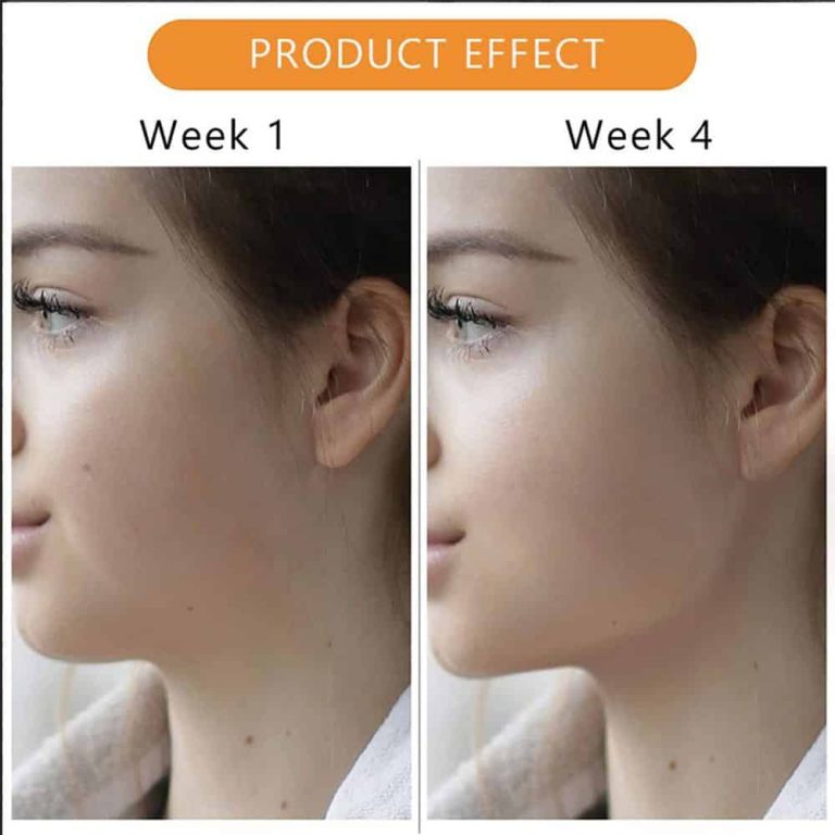 دستگاه فرم دهی صورت و زاویه فک jawline